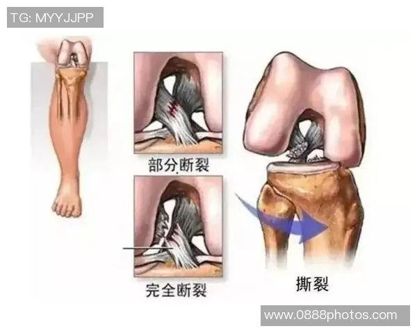 打篮球时膝盖疼痛的原因及缓解方法分享